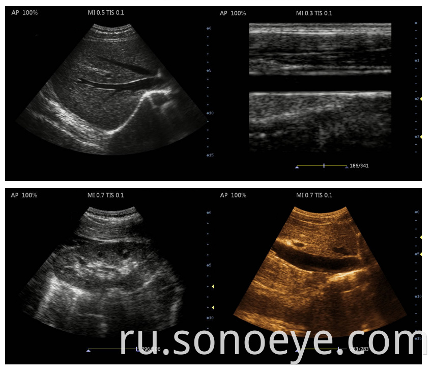 ultrasound machine laptop for Clinic